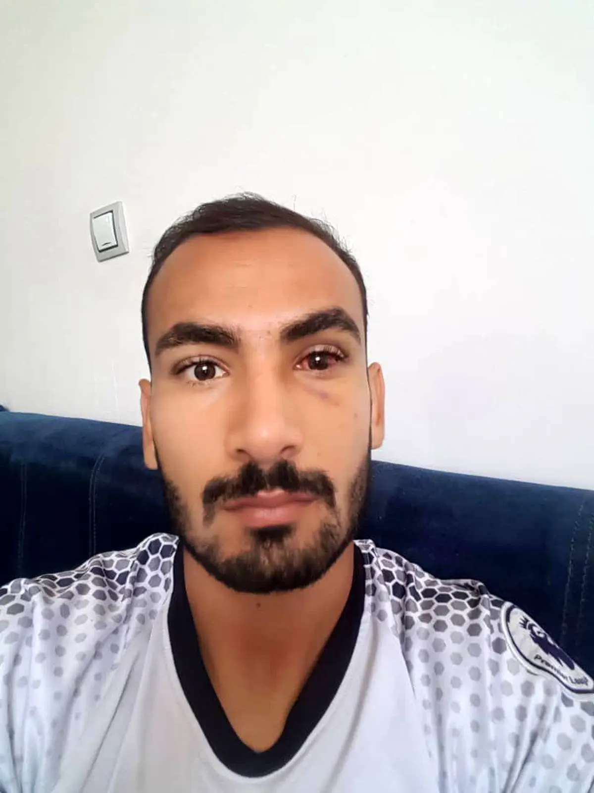 مُهر مرحله یک هشتم روی گونه مدافع فجر