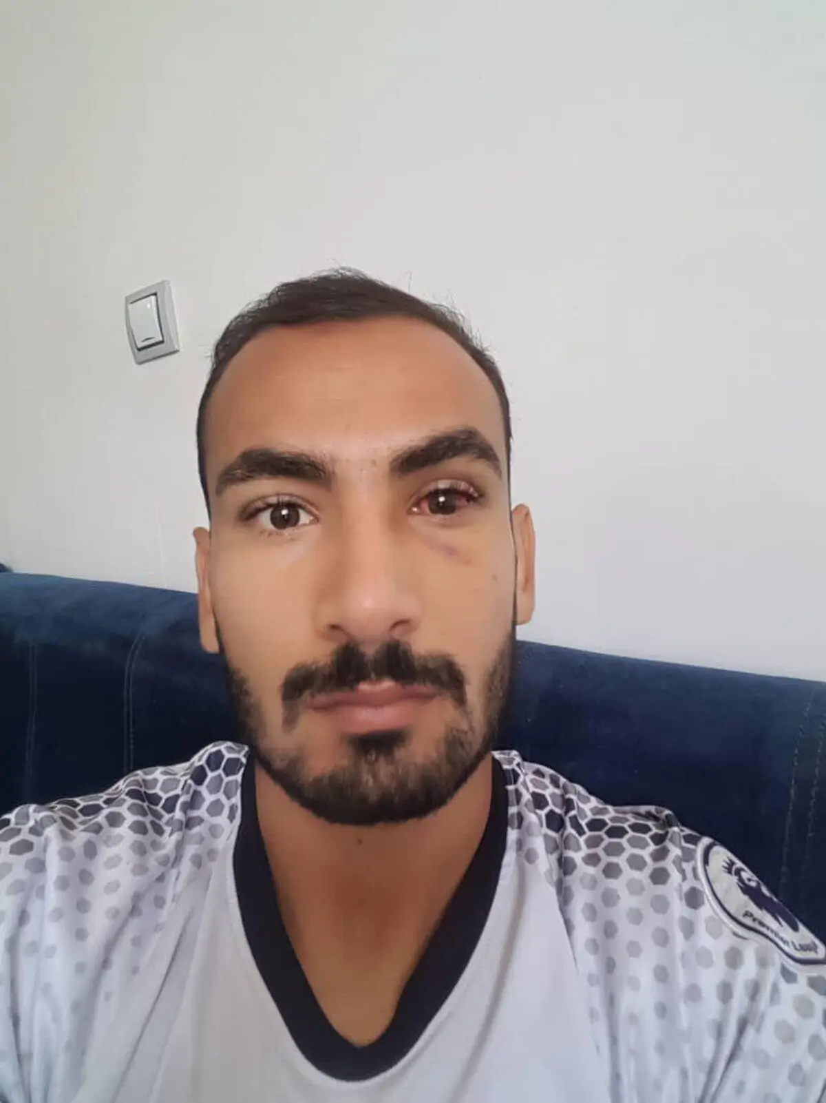 مُهر مرحله یک هشتم روی گونه مدافع فجر
