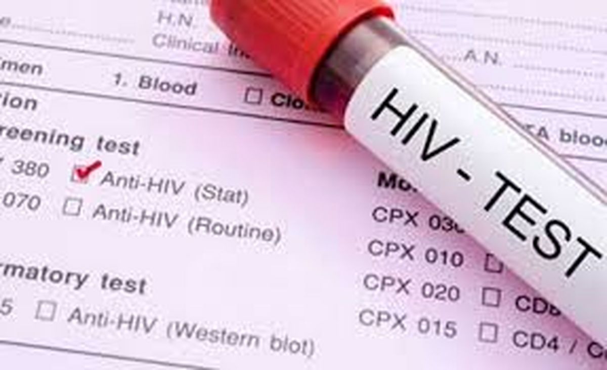 آزمایشگاه‌ها نتیجه آزمایش HIV مثبت را اعلام نمی‌کنند؟