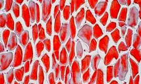 کشفی عجیب و غریب در ارتباط با استخوان‌ها 