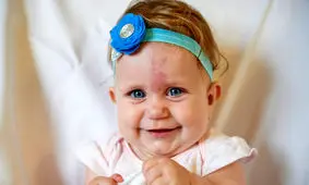 واقعیاتی جالب در مورد ماه‌گرفتگی و خال‌های مادرزادی