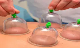کاسبی مغازه‌های حجامت در فصل بهار/حجامت، درمان و پیشگیری نمی‌کند