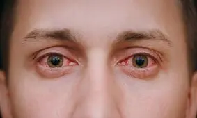 چه موقع باید قرمزی چشم را جدی بگیریم؟