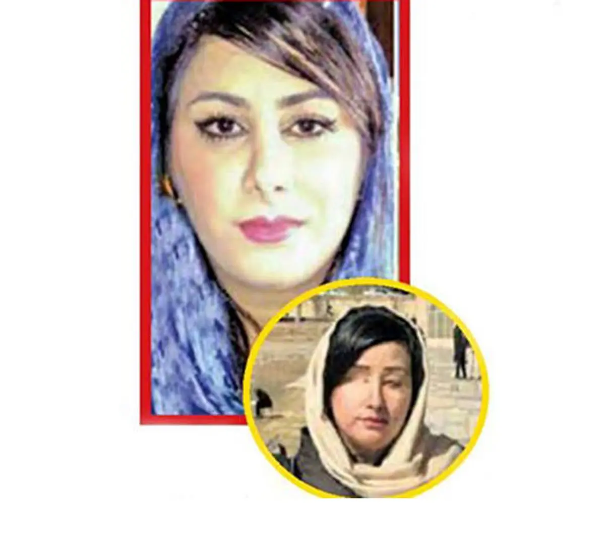 قربانی اسیدپاشی زنجیره‌ای اصفهان از 5سال زجرآور گفت / هنوز پرونده باز است!