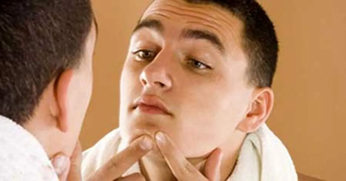 این غذاهای سالم دلیل اصلی جوش زدن هستند