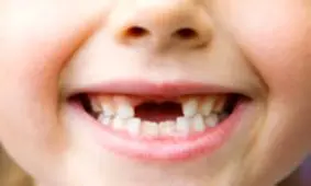 اقدام زیبای مدیر یک مدرسه ابتدایی برای آرامش کودک ۷ ساله / نامه تضمین دریافت هدیه از «فرشته دندان»