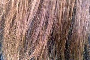 درمان موخوره با چند ترفند خانگی/ فرمول‌هایی طبیعی که موهایتان را نرم و زیبا می‌کنند