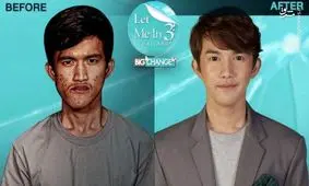 زن تایوانی، پسر خودش را بعد از جراحی پلاستیک نشناخت!