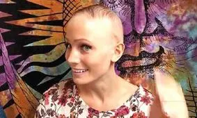 پنهان کردن طاسی از نامزد