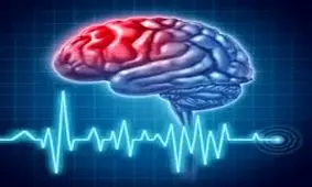 روش درمان و کاهش دردهای ناشی از سکته‌های مغزی