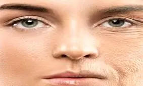 خوراکی‌هایی که برای پوست شما بهتر از بوتاکس عمل می‌کنند