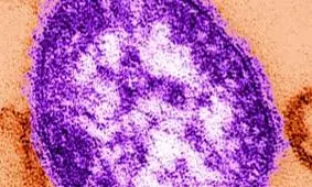 چرا باید سرخک را جدی گرفت؟