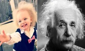 عجیب‌ترین بیماری‌های نادر جهان؛ از سندروم موی غیرقابل انعطاف تا زنی که تنها صدای همسرش را نمی‌شنود