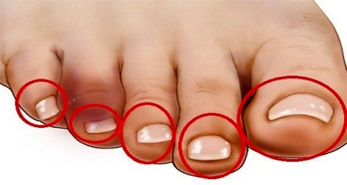 یک روش ساده که با لمس پنجه پایتان از مشکل قلبی‌تان باخبر شوید