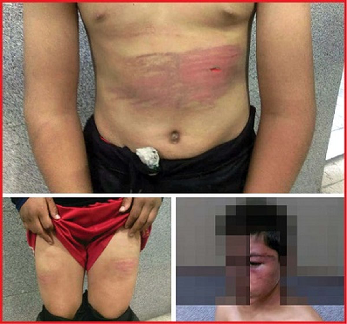 عکس های تکاندهنده از شکنجه پسر12 ساله در اتاق وحشت! / در مشهد فاش شد