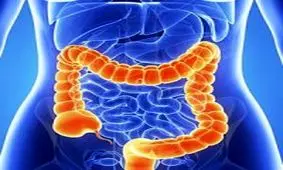 بهترین شیوه تشخیص سرطان روده