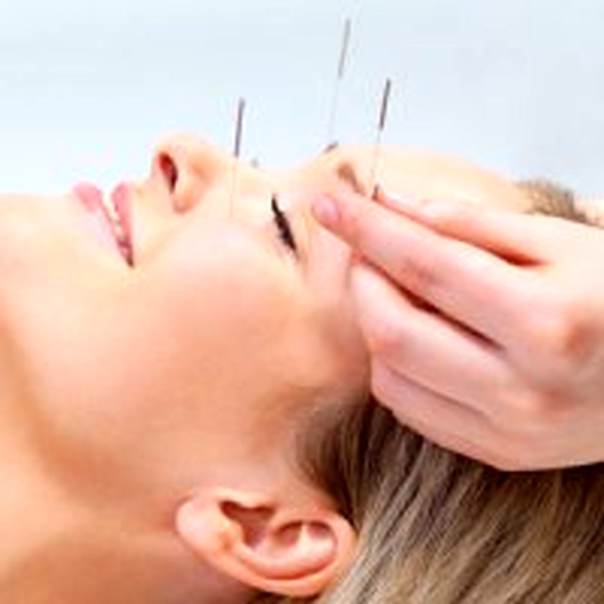 رواج طب چینی در کلینیکهای زیبایی ایرانی