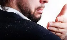 شوره سر را با طب سنتی درمان کنید