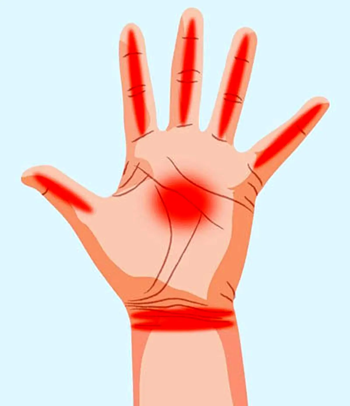 دست ها چه چیزهایی درباره سلامت ما می گویند