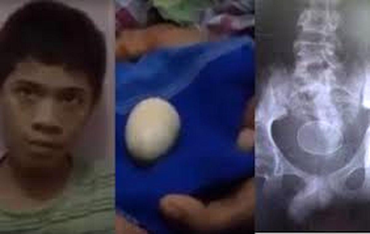 فیلم| پسر ۱۴ ساله‌ای که تا کنون ۲۰ تخم گذاشته است
