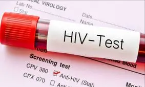 دارویی جدید برای درمان همیشگی ویروس ایدز ساخته شد