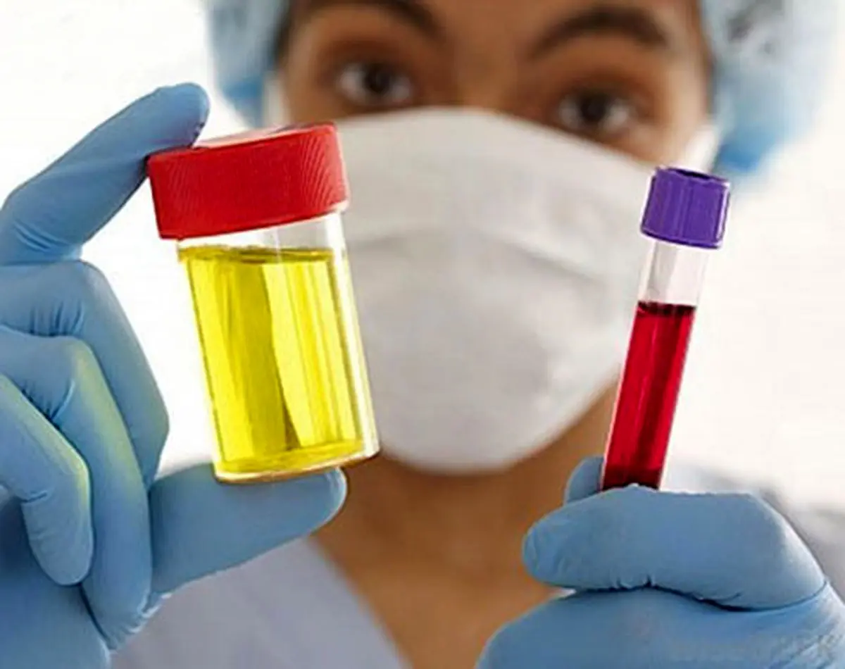 علائم سرطان مثانه کدامند؟