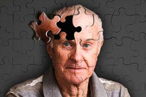 ابتلا به آلزایمر با کمبود کدام ویتامین در ارتباط است؟