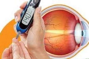 اگر دیابت دارید معاینه دوره‌ای چشم را فراموش نکنید