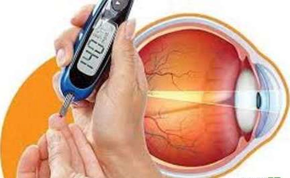 اگر دیابت دارید معاینه دوره‌ای چشم را فراموش نکنید