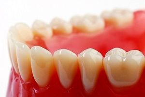 دندان مصنوعی‌هایی که باعث سرطان دهان می‌شود!