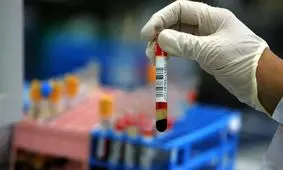 اختلالات تیروئیدی در خانم‌ها بیشتر است یا آقایان؟