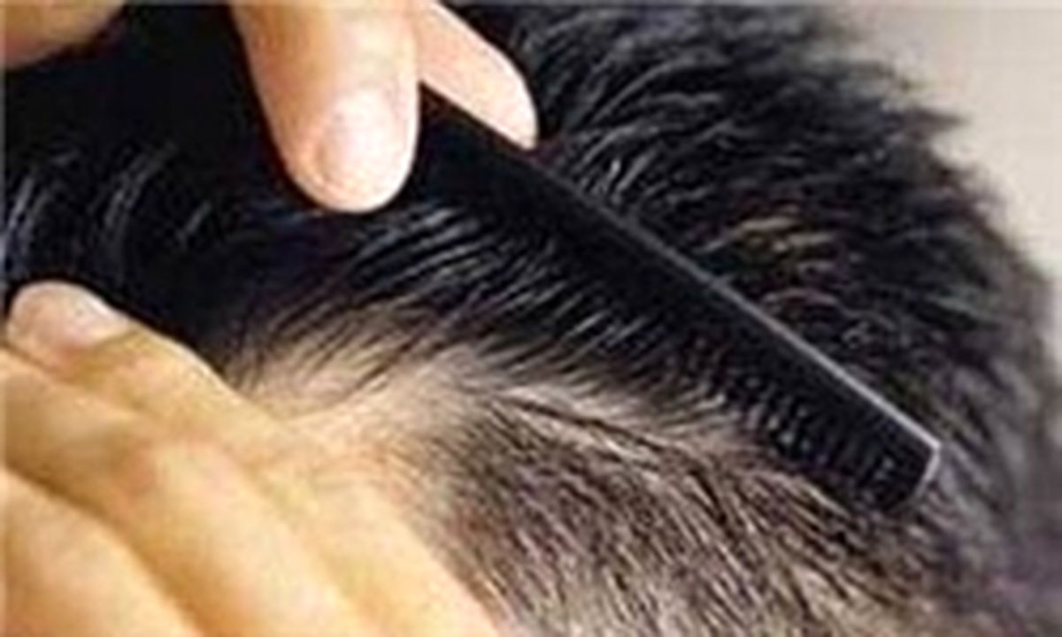 تأثیر رنگ مو در بروز بیماریهای قلبی
