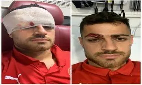 مصدومیت وحشتناک پورعلی گنجی در قطر