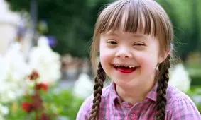 افراد موفقی که سندروم داون دارند