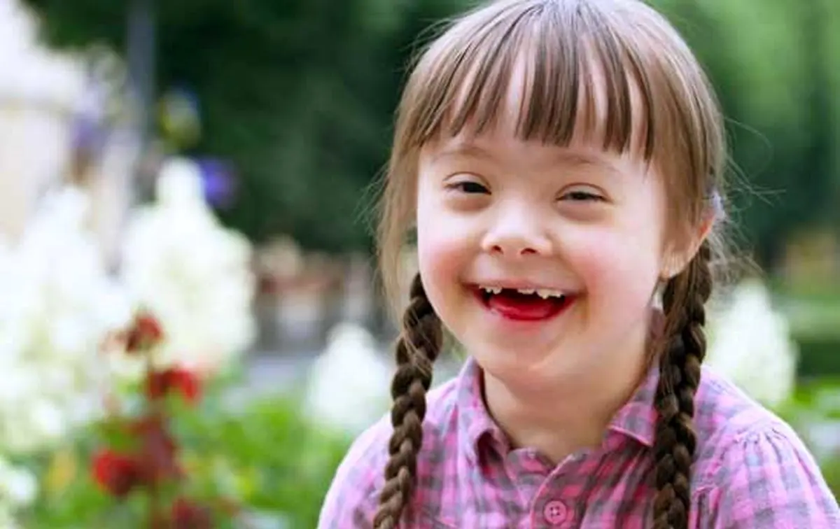 افراد موفقی که سندروم داون دارند