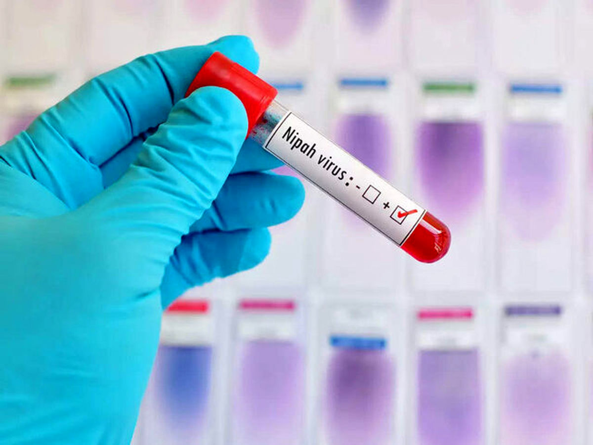خطر همهگیری ویروس شایع شده در مناطقی از آسیا