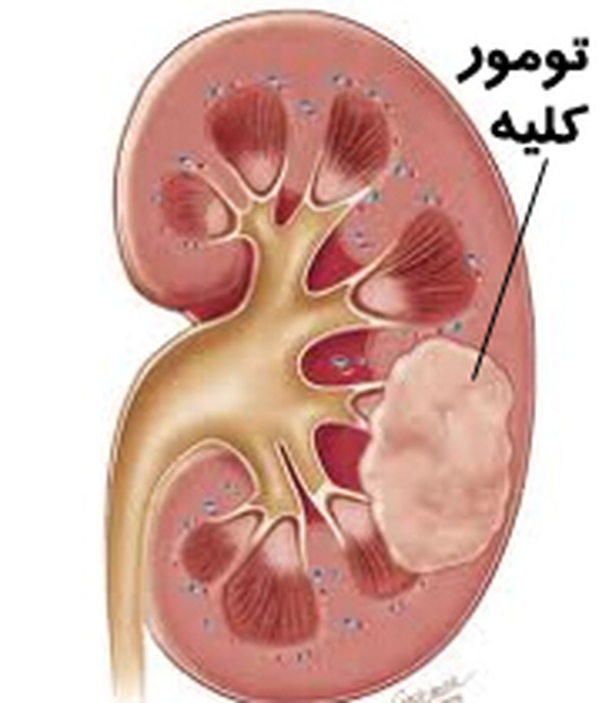 12 علامت هشدار دهنده بیماری تهدیدکننده زندگی!