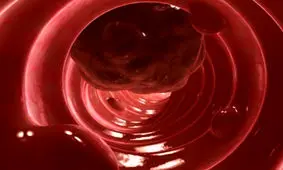 روشی نوین برای جلوگیری از رشد سرطان روده بزرگ