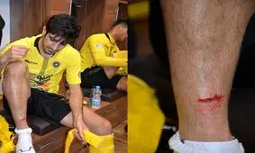 حسینی: خدا رحم کرد پایم نشکست