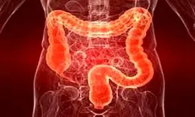 حرکت ورزشی برای مبتلایان به سندروم روده تحریک پذیر