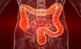 حرکت ورزشی برای مبتلایان به سندروم روده تحریک پذیر