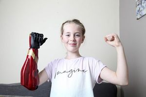 کمک فناوری رباتیک به دختر معلول انگلیسی