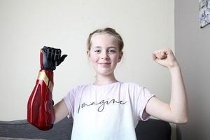 کمک فناوری رباتیک به دختر معلول انگلیسی