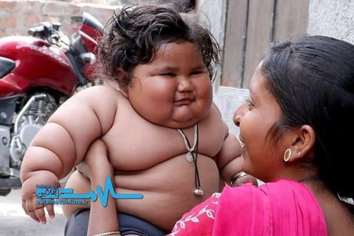 دختری 8 ماهه با اشتهایی سیری‌ناپذیر +تصاویر