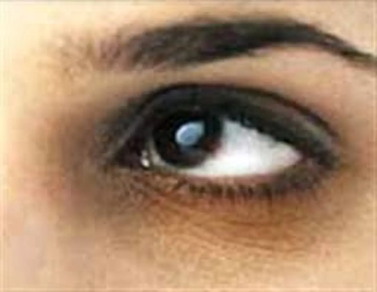 تیرگی دور چشم‌های خود را با این روش نابود کنید