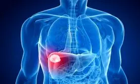 با دیدن این نشانه ها بدانید به بیماریهای کبدی مبتلا شدید