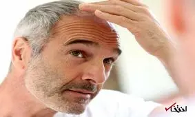 تغییرات موهای شما نشان دهنده بیماری شماست