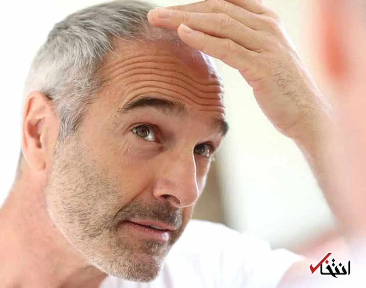 تغییرات موهای شما نشان دهنده بیماری شماست