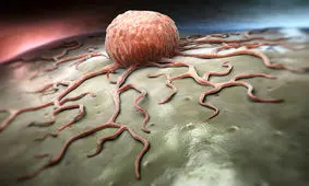 خطر افزایش بروز سرطان در سال‌های آتی