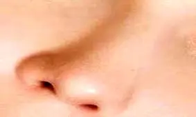 سـودای بینی نقلی!